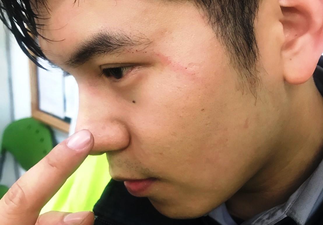 新莊尤姓員警被鋸銅像民眾攻擊，臉部有挫傷。