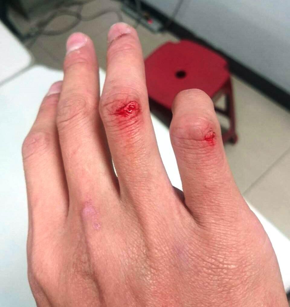 尤姓警員手部滲血，還有多人掛彩。