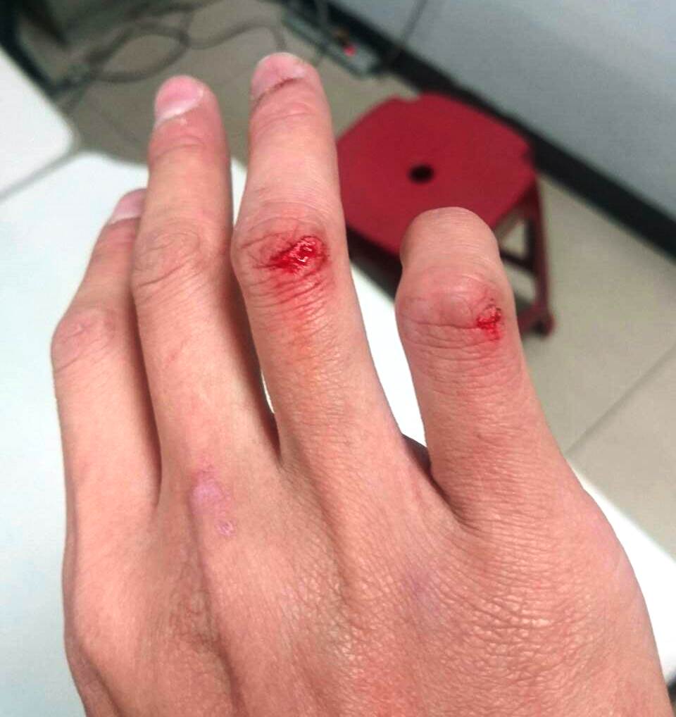 尤姓警員手部滲血，還有多人掛彩。