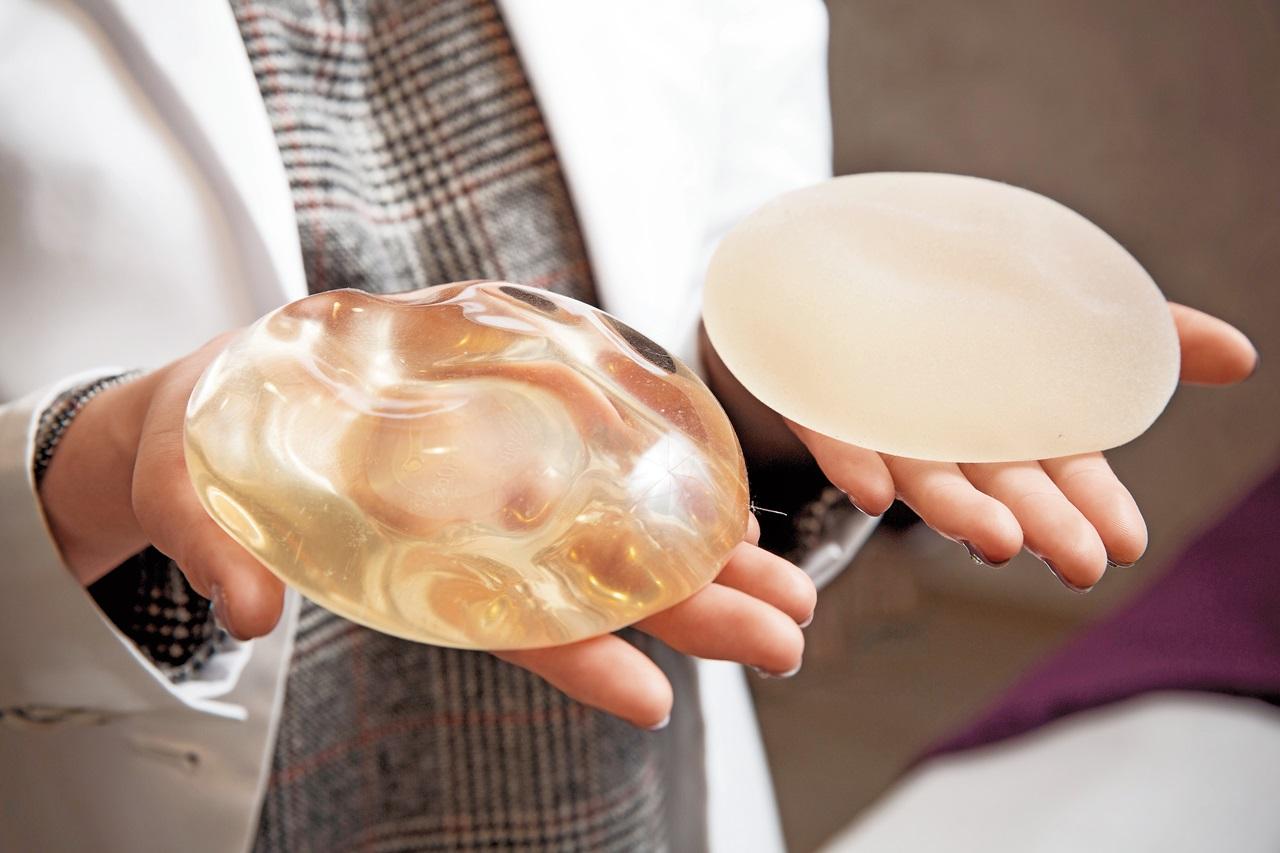 現在隆乳手術常用果凍矽膠當填充物(圖),若術後照顧不良,就會發生莢膜攣縮(圖),得動手術取出。