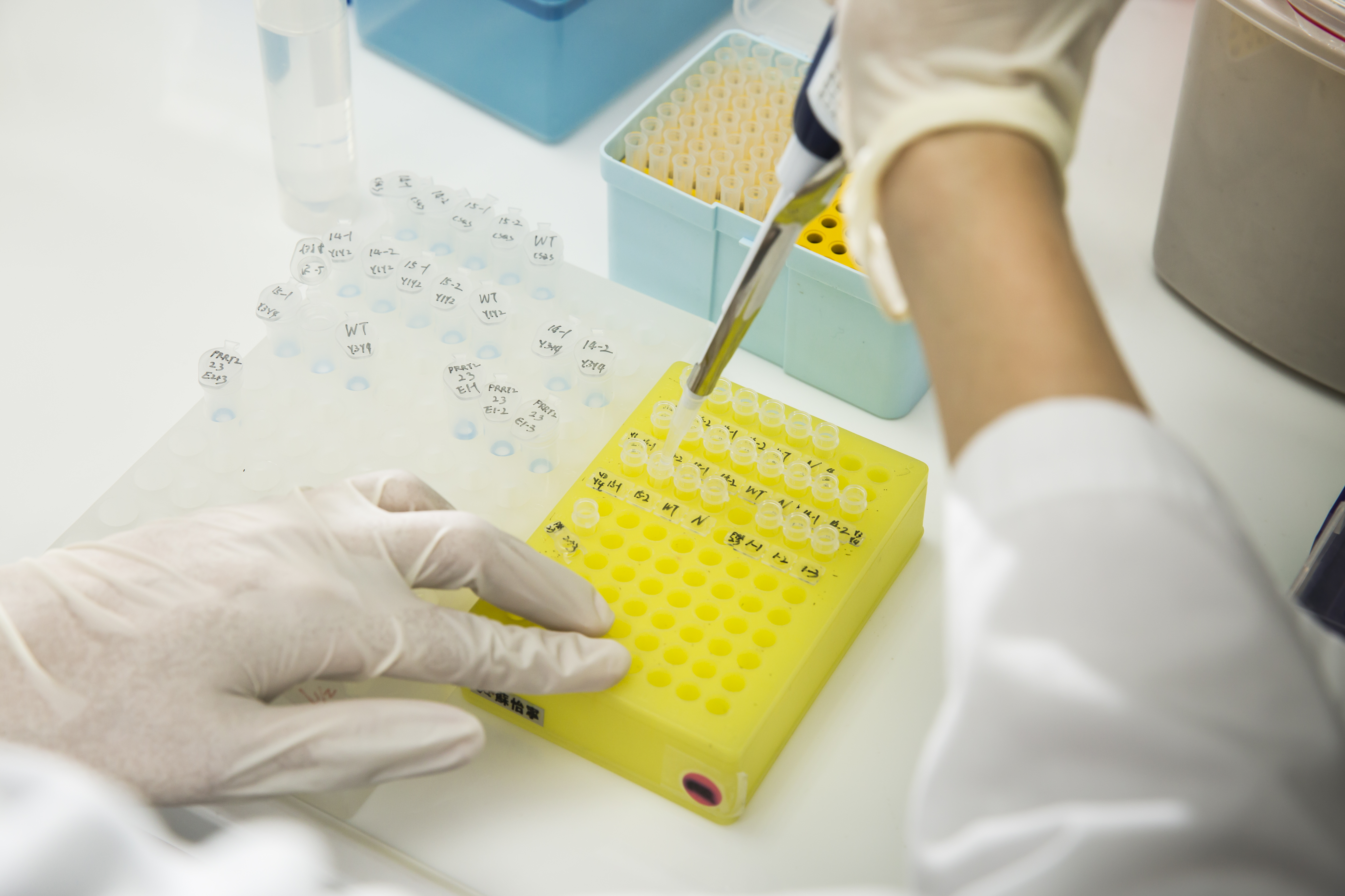 慧智基因能診斷超過1000種基因異常，分裝後的DNA，依據客戶指定的基因檢測，在DNA內加入不同試劑，以進行後續檢測。