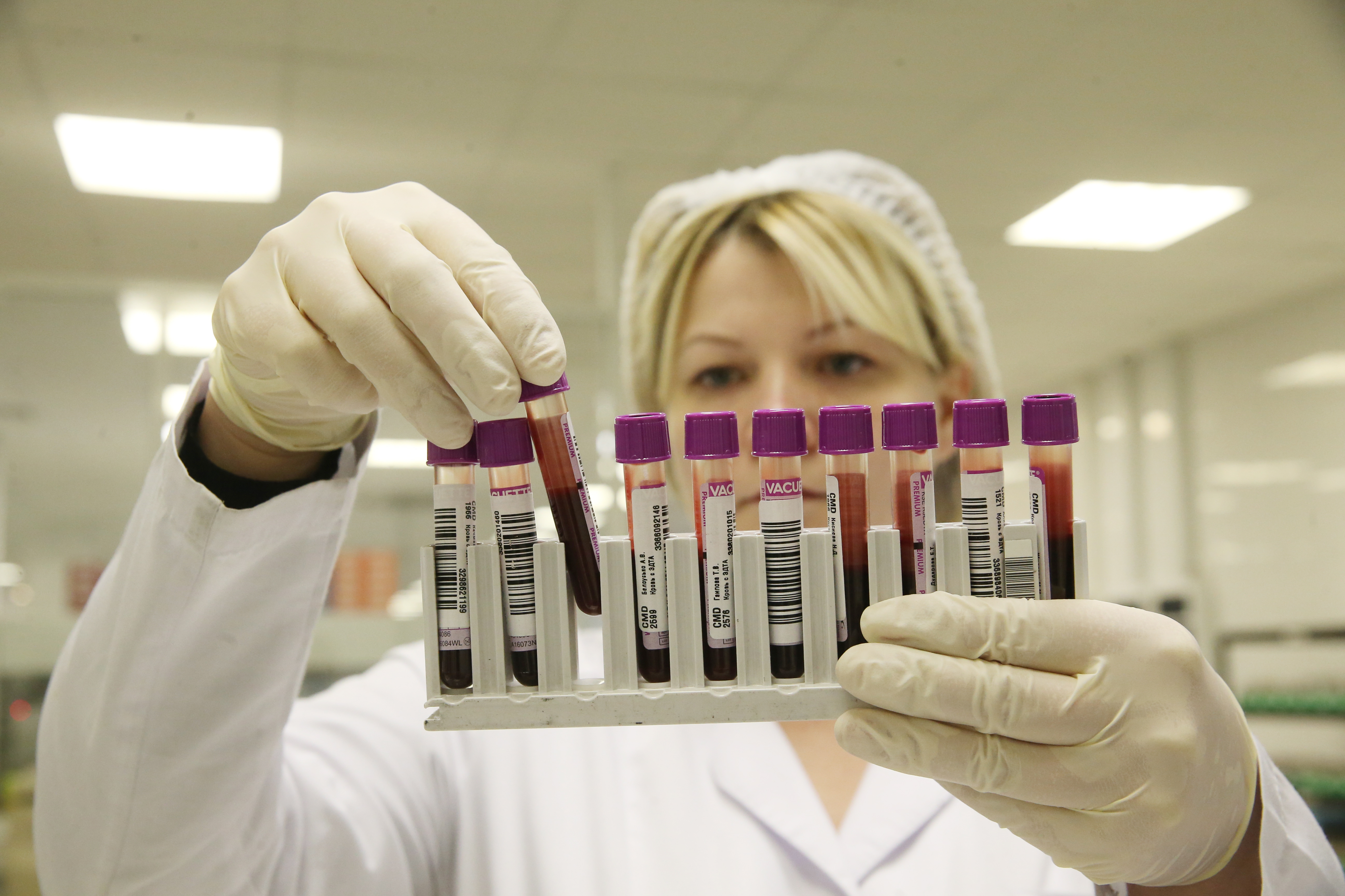 最新驗血快速檢測，可望成為結核病醫療一大福音。（東方IC）