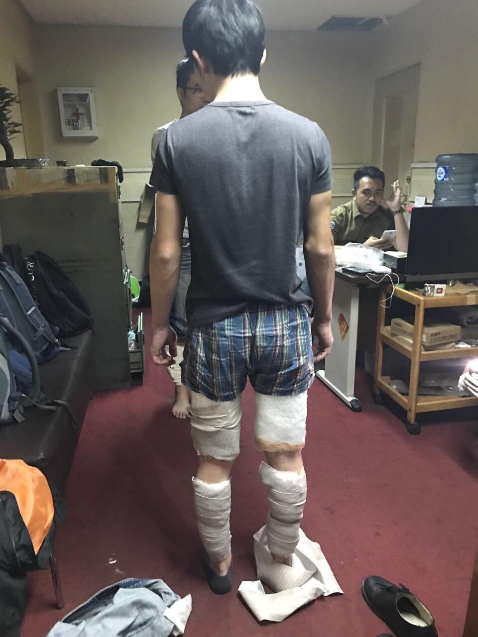 賴嫌等人將毒品綁在腿上,還是被印尼海關查獲。