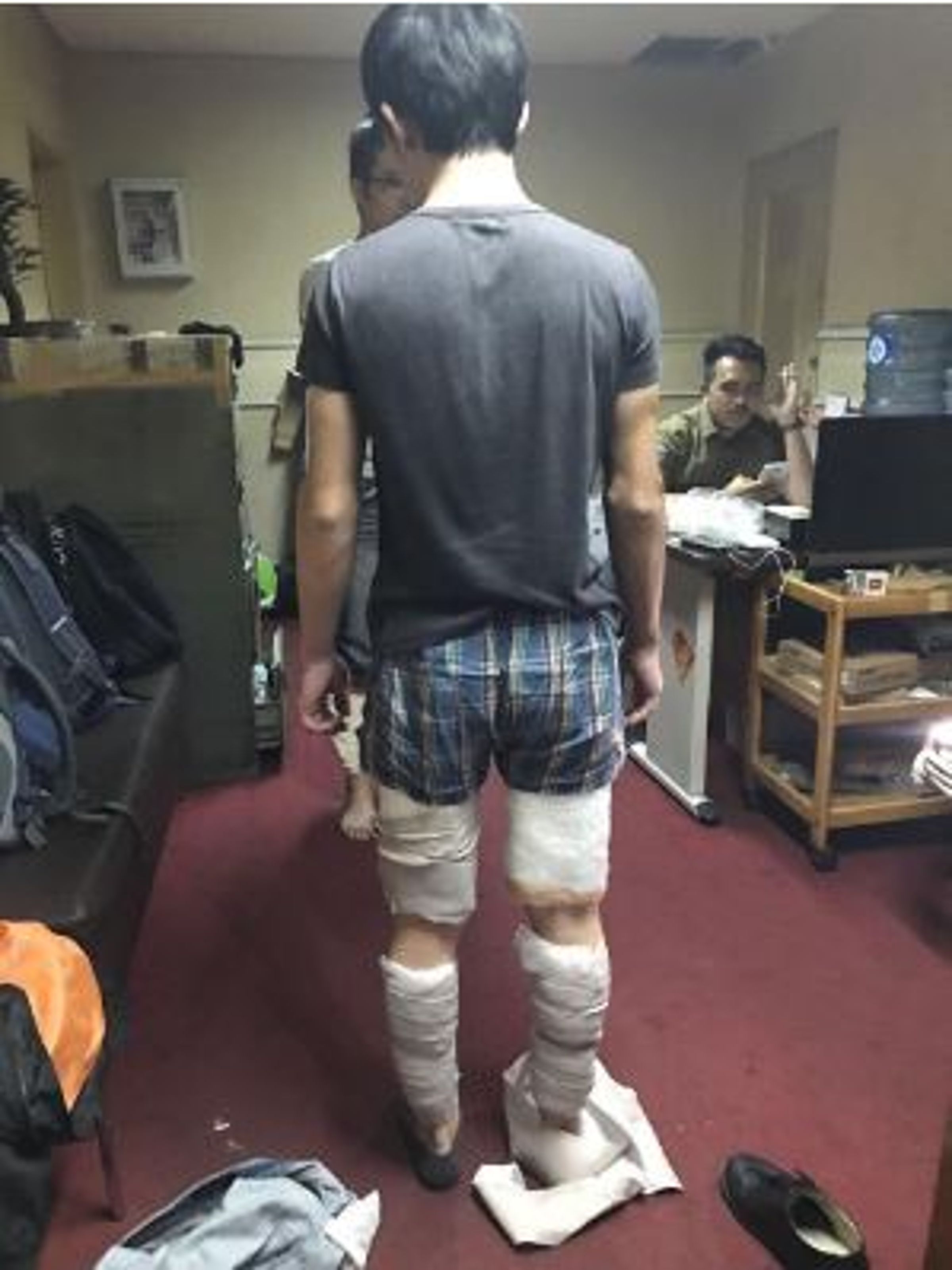 2名台灣年輕人將毒品綁在腿上，被印尼海關及警方查獲。