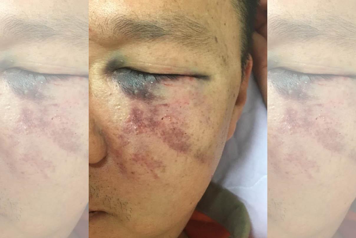 蕭姓男子接小孩卻被打到住院,其親屬將傷勢放上網路提醒民眾注意。
