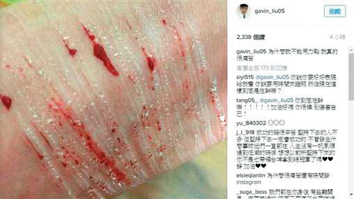 劉錚曾在IG貼出一張疑似自殘的照片，讓粉絲相當擔心。（翻攝自劉錚IG）