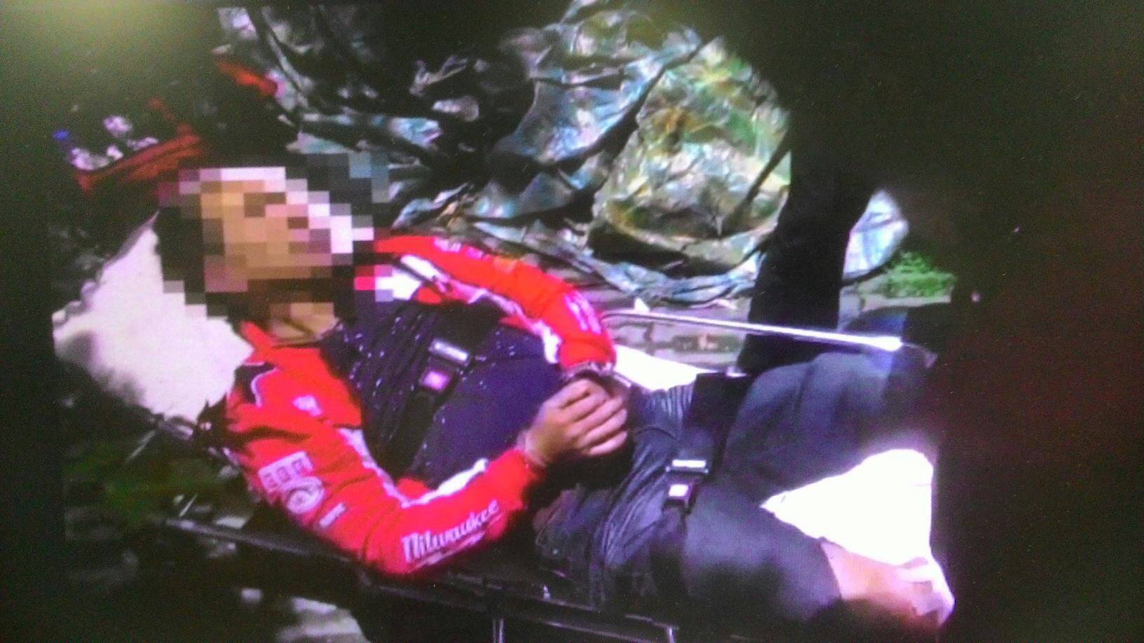 王端彬腿部中彈後送醫動手術取出子彈，已無大礙。