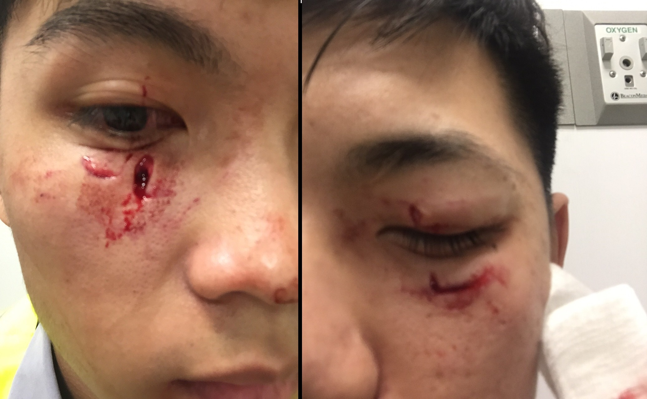 金城派出所兩名員警為了壓制醉漢，臉部掛彩。