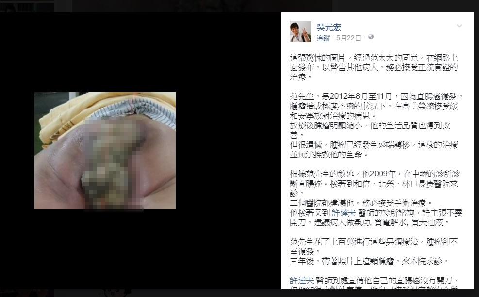 榮總醫師吳元宏日前在臉書發表「不自殺聲明」，披露一名直腸癌病患因聽信知名「自然療法」醫師許達夫的建議，買產品、喝電解水，錯過黃金治療時機，最後因腫瘤復發送命。