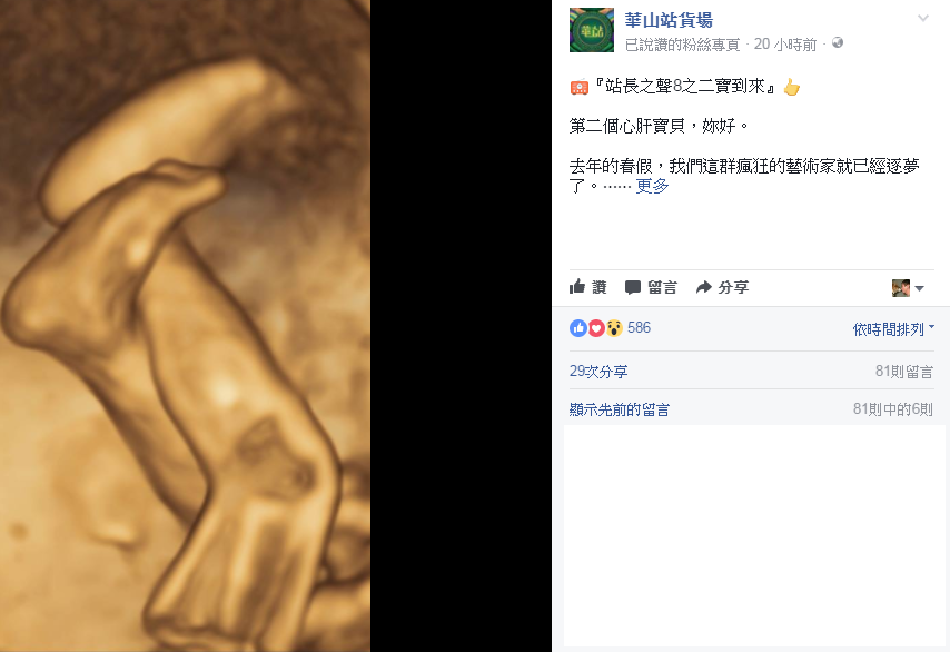 阿福在臉書宣布將迎接第二個小寶貝的來臨，秀出女娃一雙美腿。