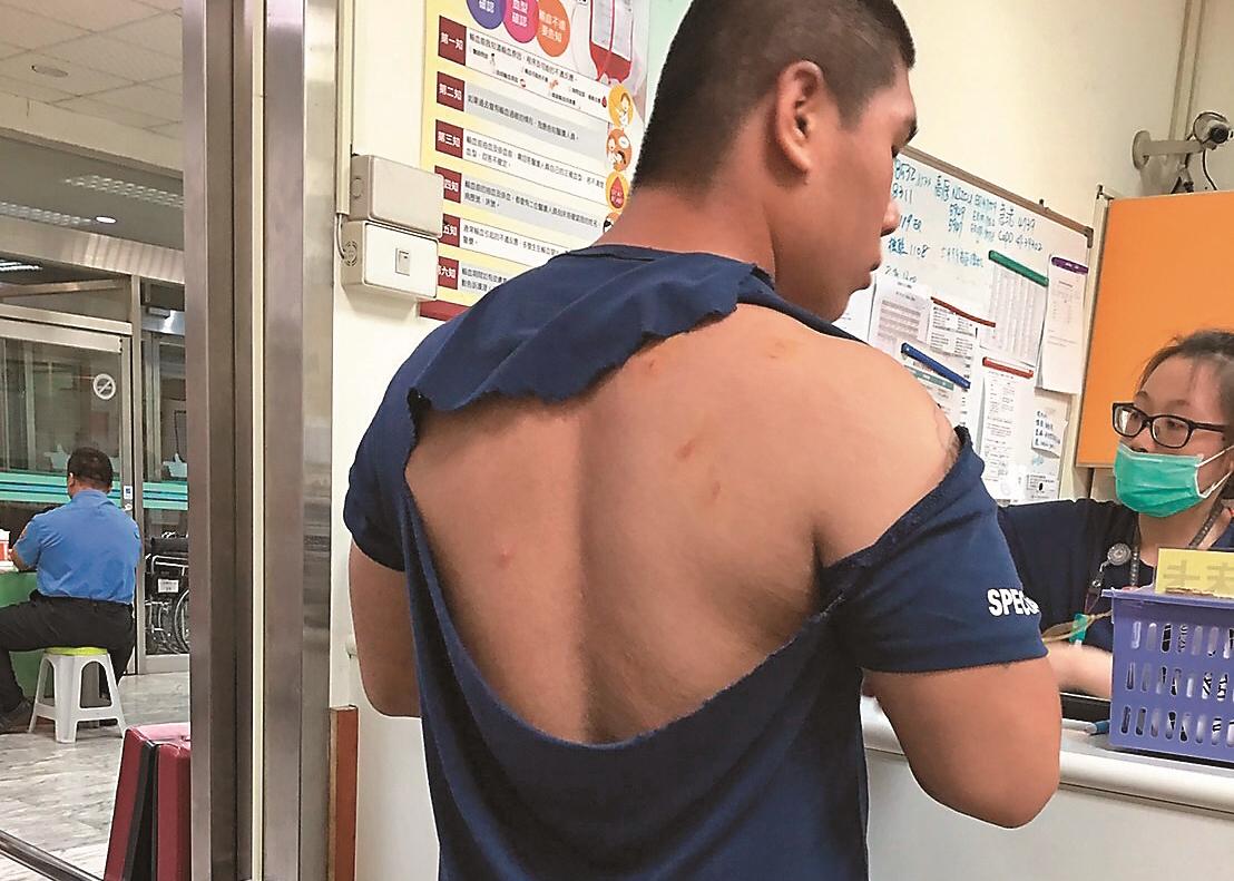 參加廟會盛事志工無端被痛毆，里民背部傷痕累累，衣服更因為拉扯被撕爛。