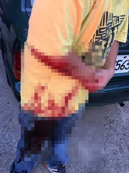 朱女大兒子護母搶槍，右臂被射傷，只能眼睜睜的看著「叔叔」殺死母親。