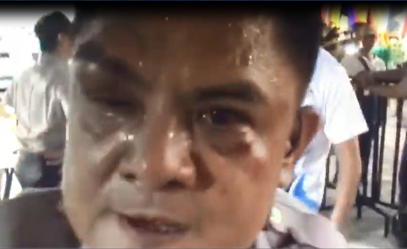 萬華分局員警遭陳抗民眾毆傷。