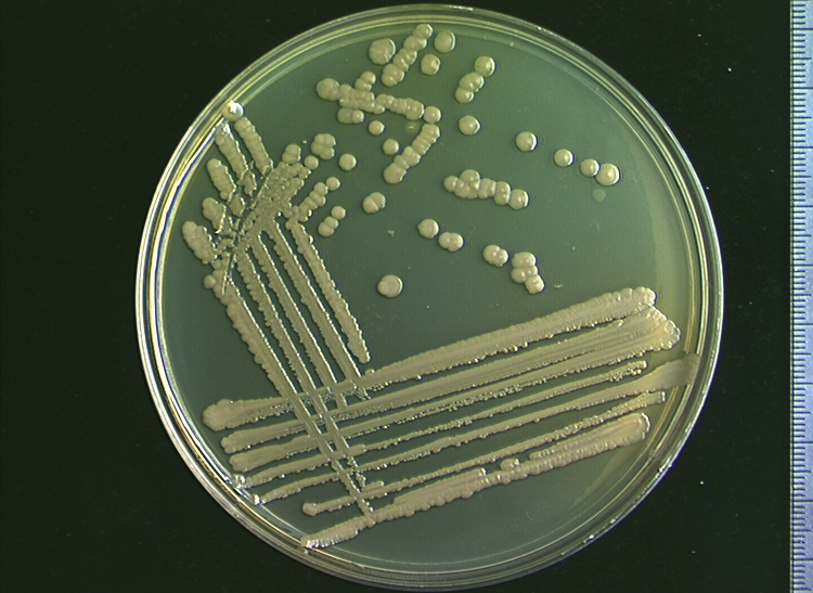 顯微鏡下的脲芽孢八疊球菌。圖片來源：Alchetron