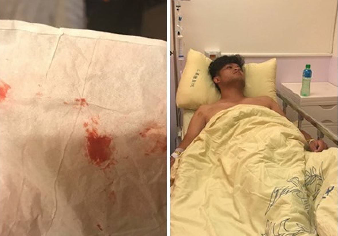 謝淑薇po出弟弟謝政鵬咳血仍備戰的照片。