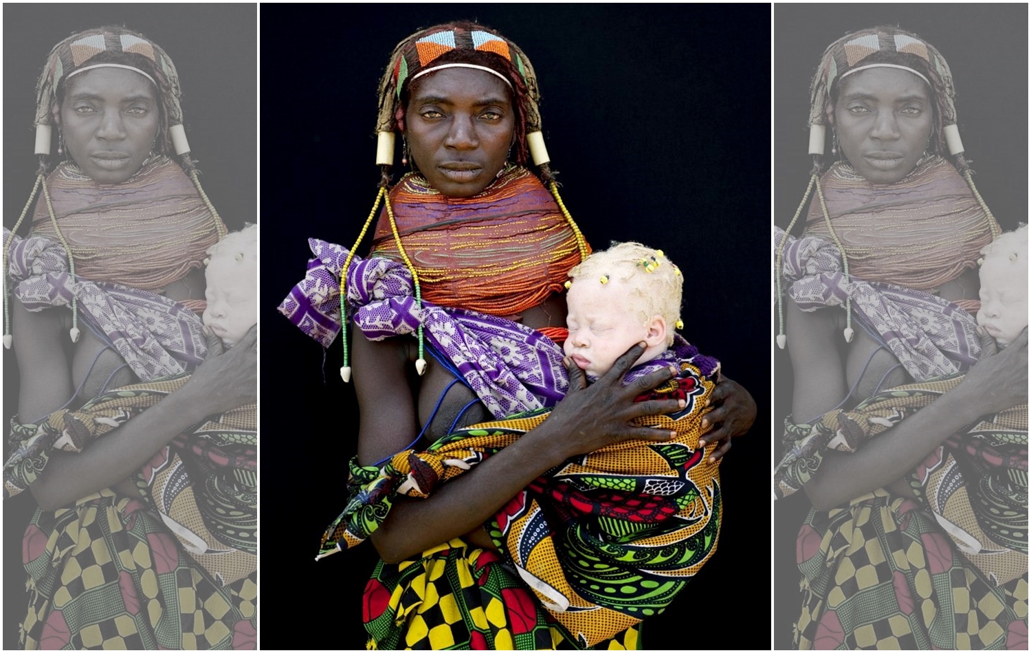 白化症是先天基因缺陷造成，患者常受不當歧視。圖為安哥拉姆維拉部落一名黑人婦女與其白化病嬰兒。