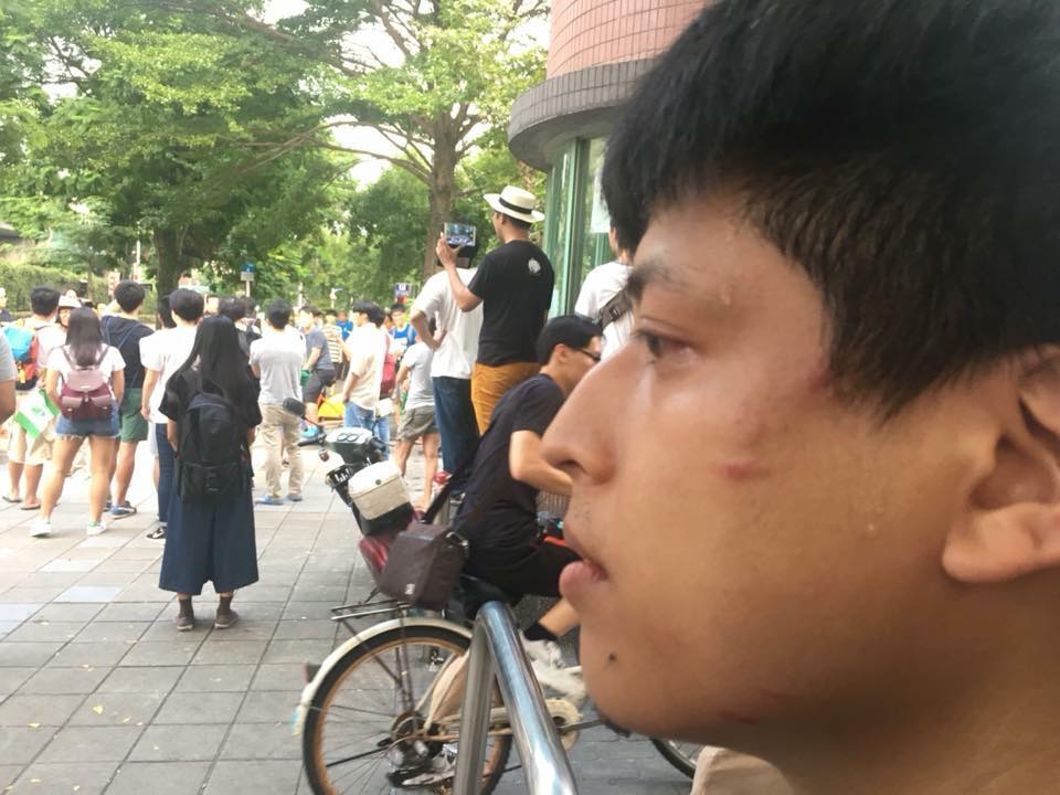 李柏璋左臉頰也遭毆受傷。