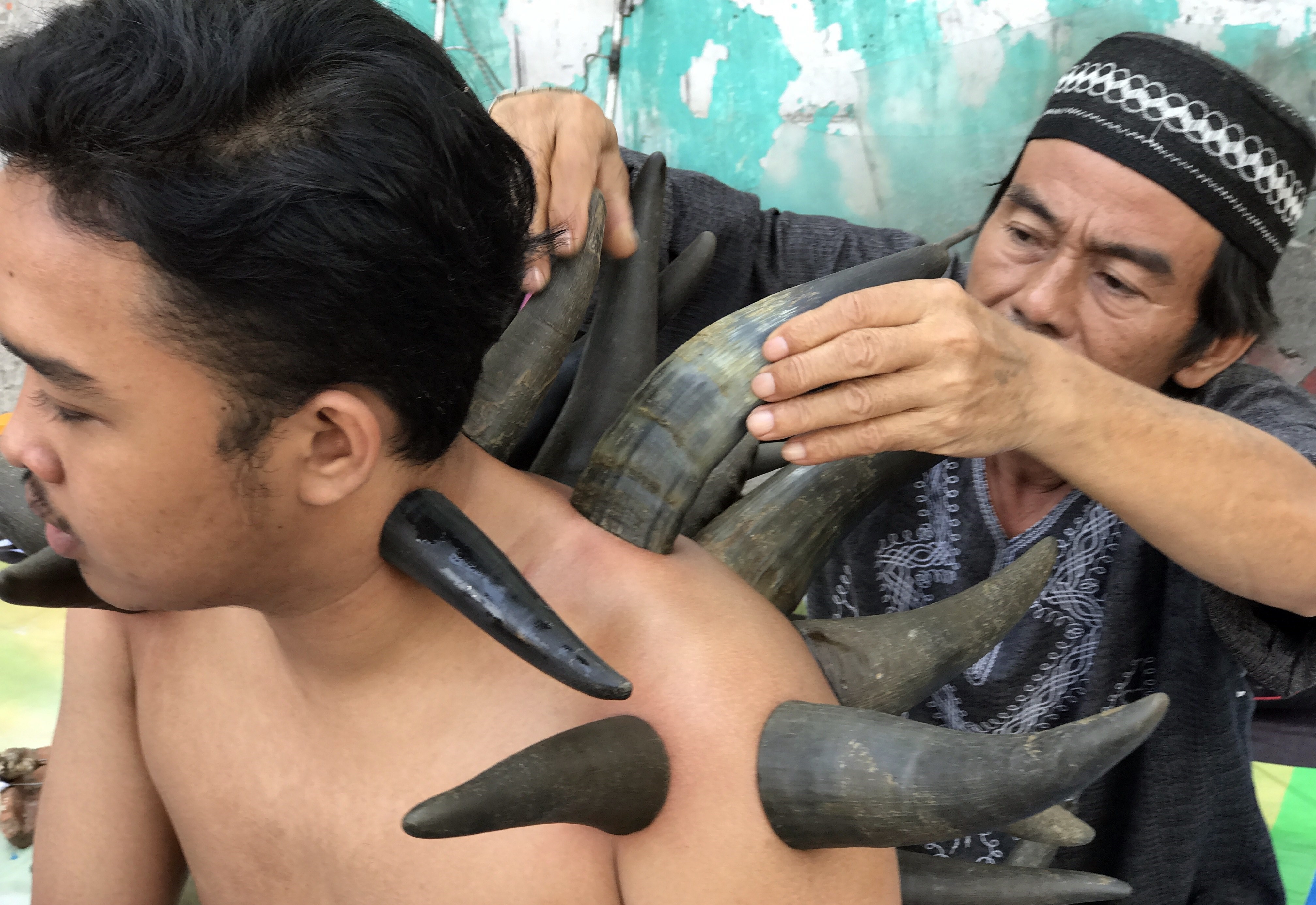 印尼街頭出現治療師以牛角為人拔罐的景象。（東方IC）