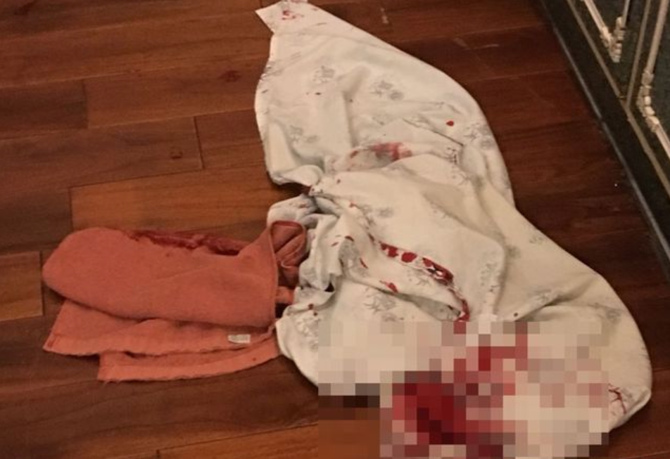 夜店殺警嫌犯周柏諺遭人砍傷，現場留下沾滿血跡的浴袍。（翻攝畫面）