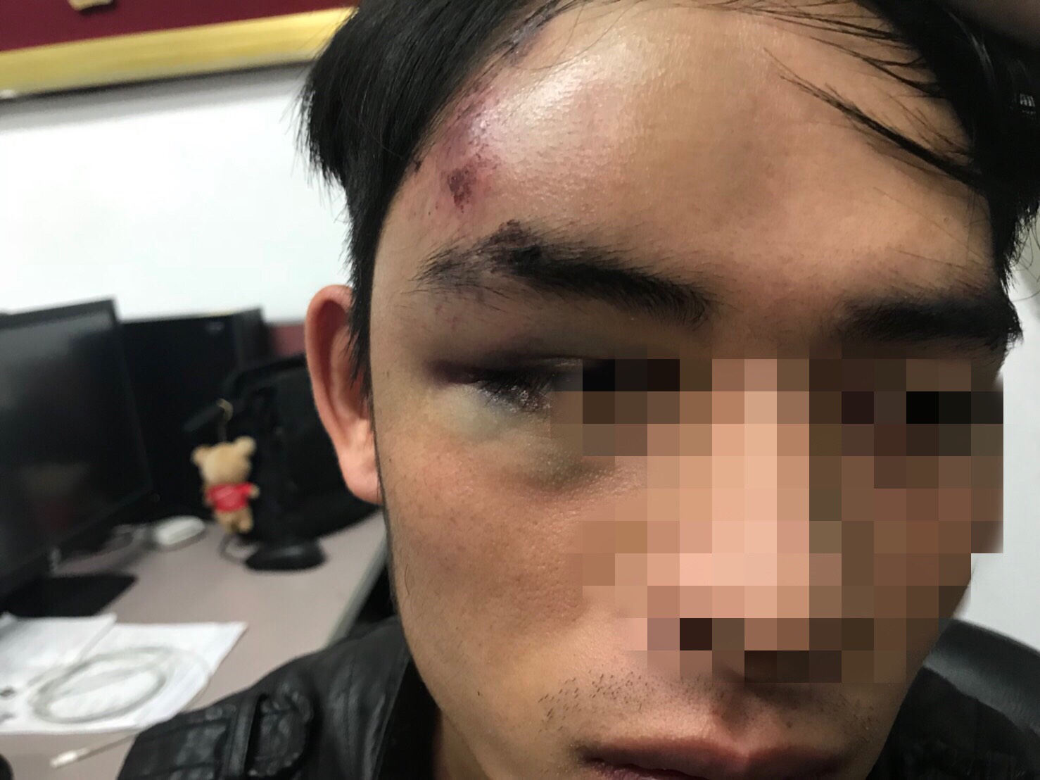 被3嫌毆打的阿德眼角額頭都有撕裂傷。(翻攝畫面)