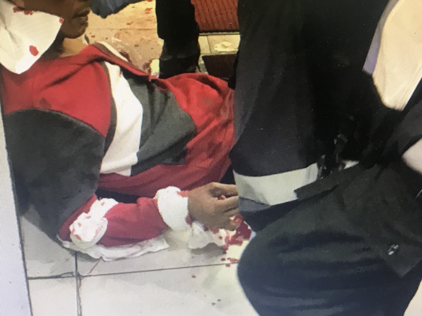 葉姓板模工廠老闆的右手被砍三刀，當場鮮血直流，皮開肉綻。（警方提供）