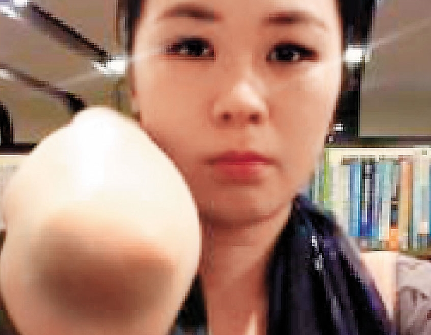 王思涵（圖）在2014年婚前即曾遭黃健維動粗打傷手肘。（讀者提供）