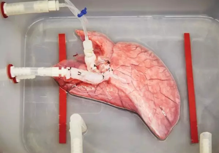 該過程的第一步是將動物器官的循環系統連接到一個泵上，將清潔劑注入器官。圖為豬肺。