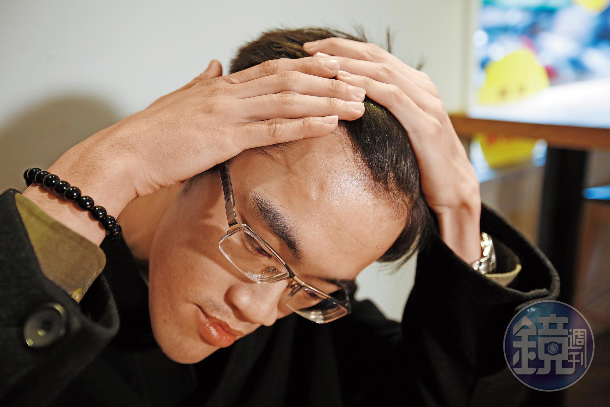 劉育宗掀起瀏海，額頭還能清楚看見車禍留下來的傷疤。
