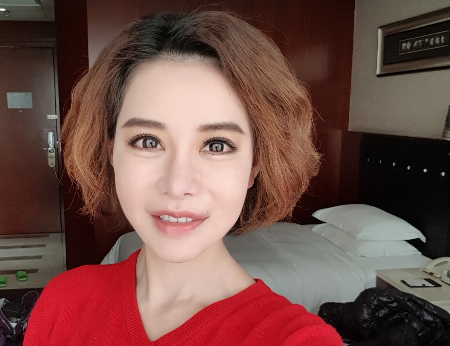 斯容前前後後整形超過60次，她因為打玻尿酸消化時間不均勻，嘴唇變得厚薄不均，削骨也造成她臉麻面僵還蛀牙。