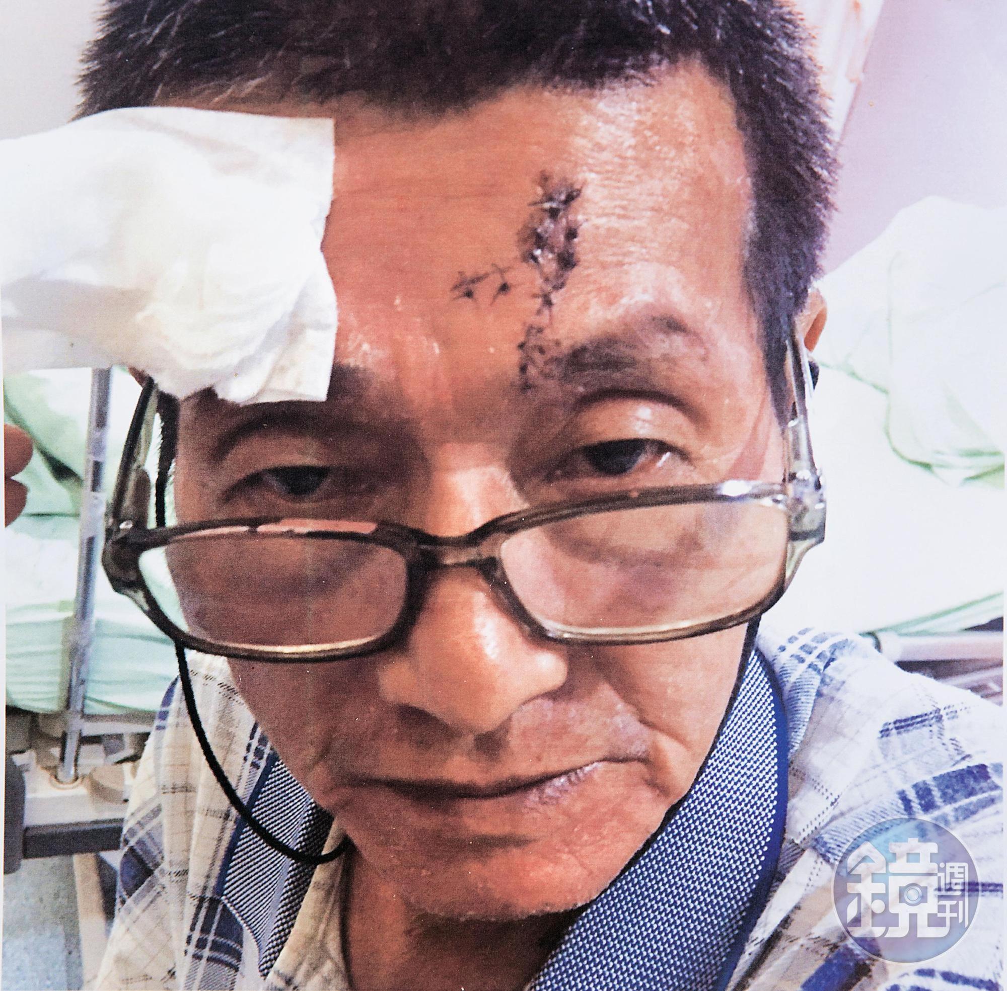 陳文顓（圖）拿出自己遭毆傷的照片，痛批侄子枉顧倫理，侵門踏戶到造船廠逞凶。