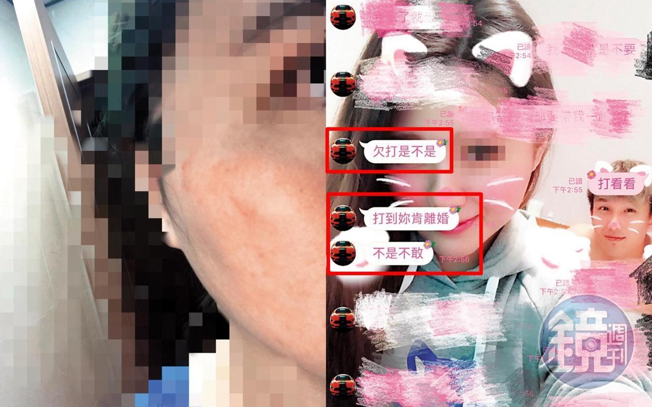黃勝雄怒打黃妻好幾個耳光，事發後2小時，黃妻的臉部依舊紅腫可見。