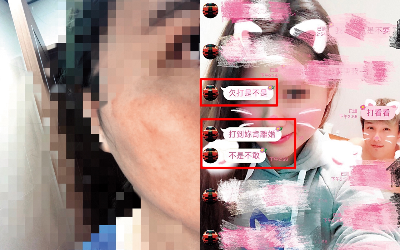 黃勝雄怒打黃妻好幾個耳光，事發後2小時，黃妻的臉部依舊紅腫可見。