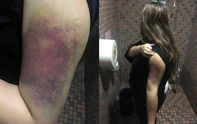 朱男的妻子遭他毆打成傷。（翻攝自網路）