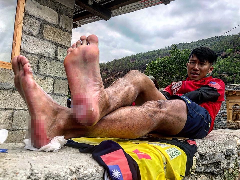 台灣極地超馬好手陳彥博於臉書po出比賽動態，他雙腳後跟嚴重破皮，甚至用肉眼就可直接看見他的肉。（翻攝自陳彥博臉書）