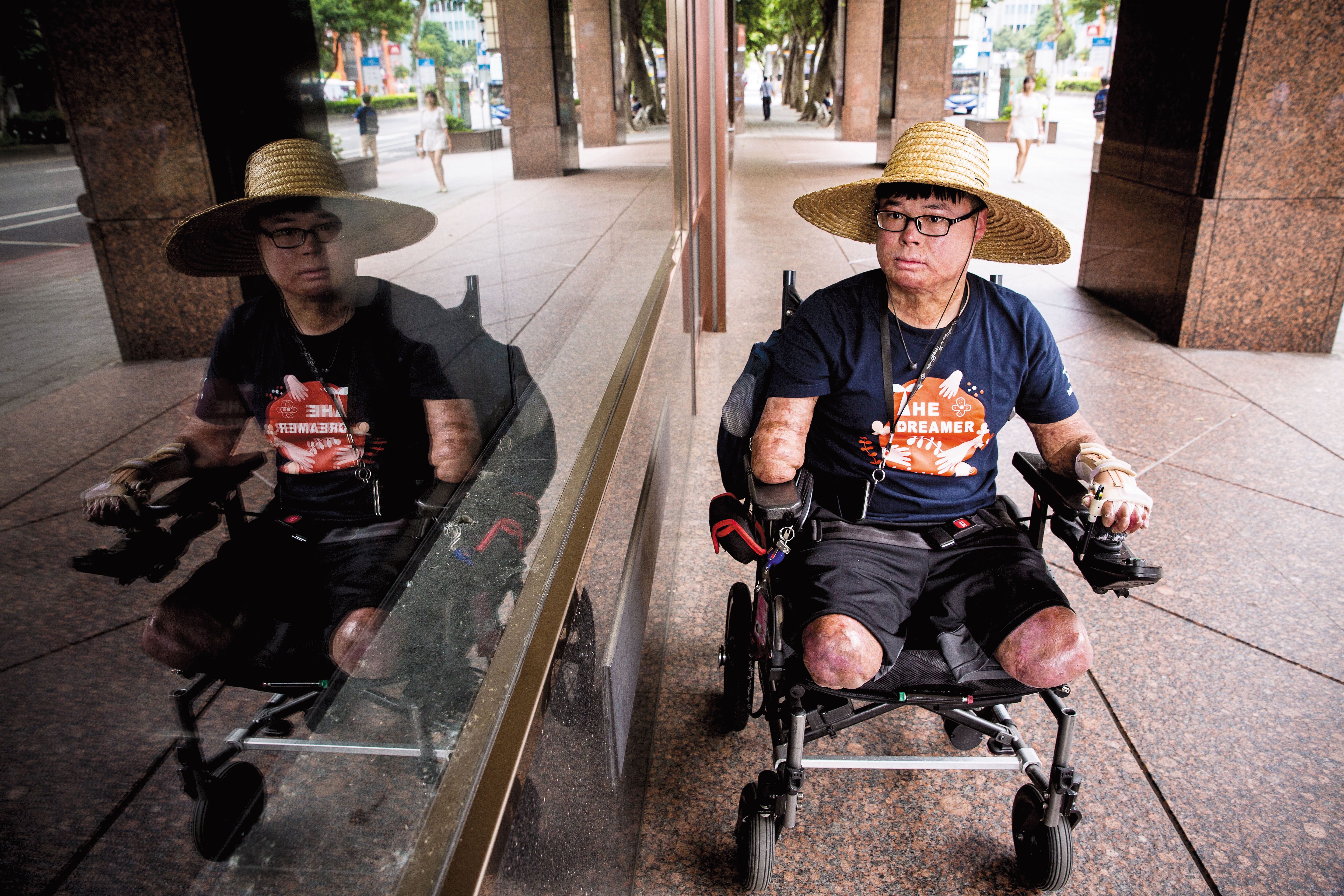 八仙塵爆雖近3年過去，傷者仍不宜曬太陽。物理治療師陳偉修說，燒燙傷患者沒有汗腺，一熱就會癢，且曬黑的皮膚無法恢復，不曬太陽是一輩子的功課。