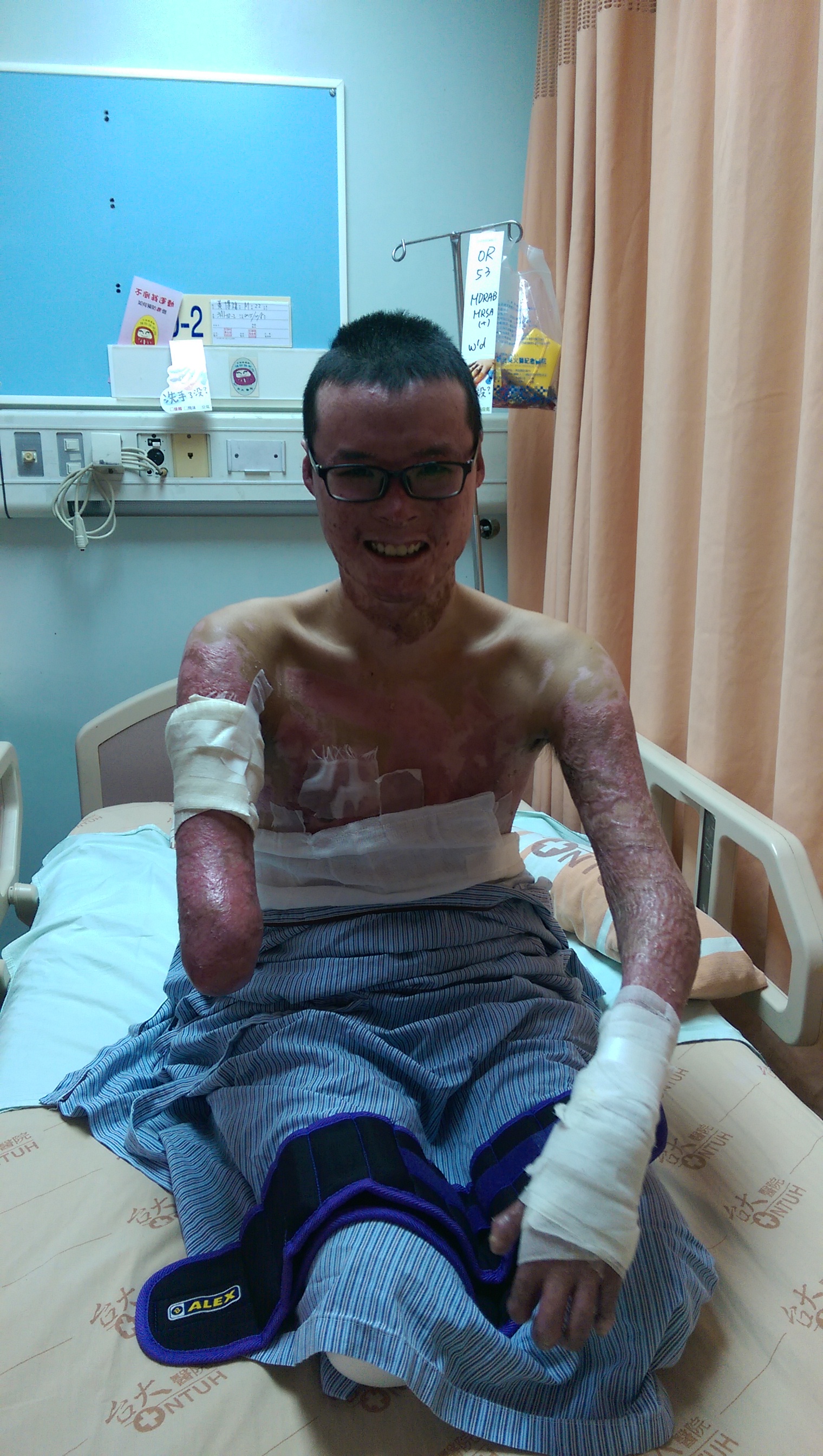 黃博煒沒有後悔過截肢的決定,截後生活也不著眼於失去的,而是還在的,就像哥哥曾經對他說:「沒燒到腦子,很多事都還是可以做的。」(黃博煒提供)