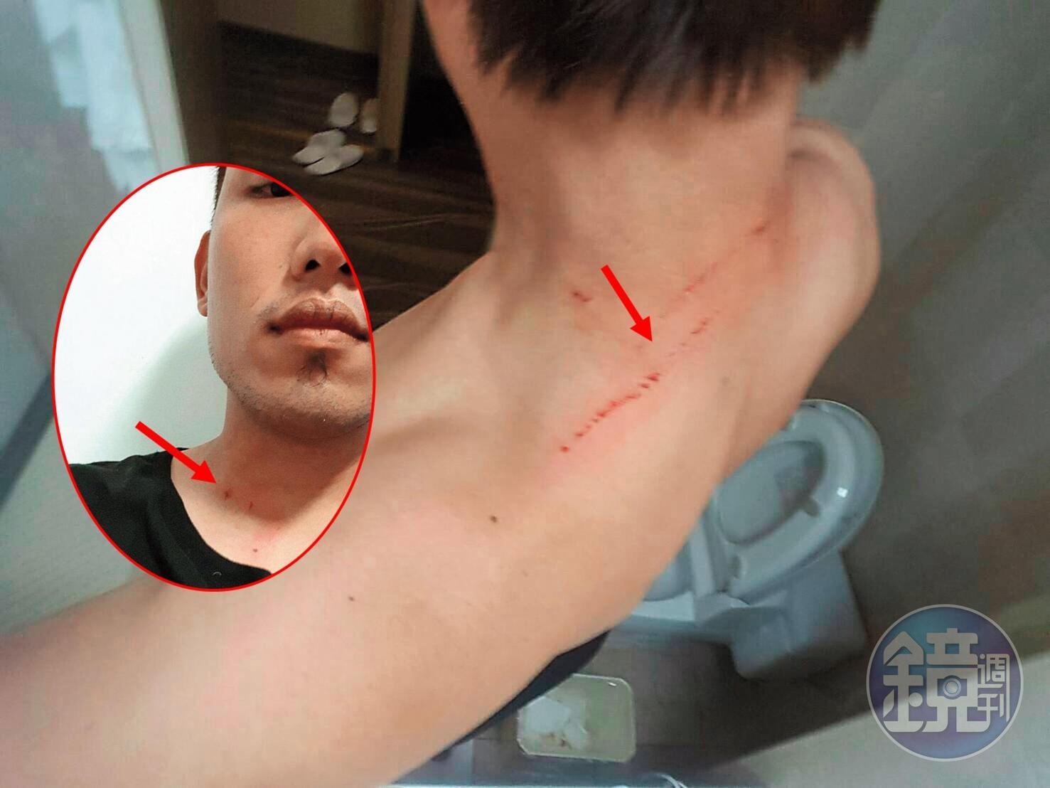 雖被指控家暴，黃勝雄也認為自己是家暴受害者，常常跟老婆吵架就被抓得滿身傷。