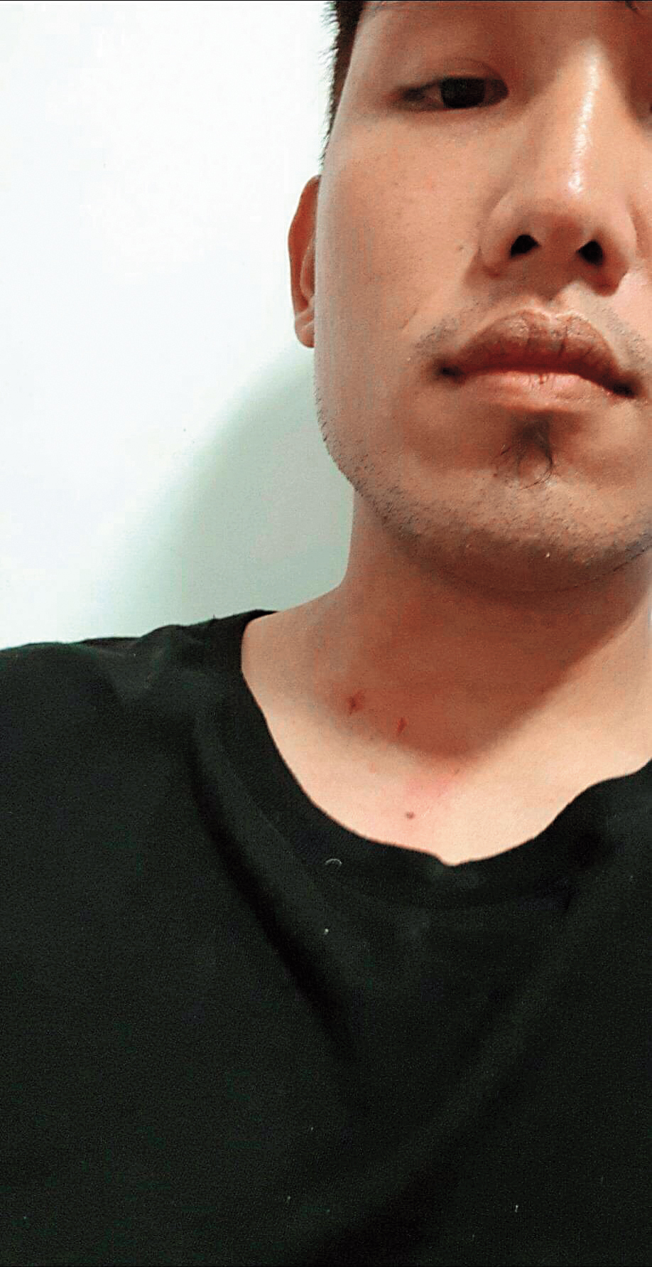 雖被指控家暴,黃勝雄也認為自己是家暴受害者,常常跟老婆吵架就被抓得滿身傷。