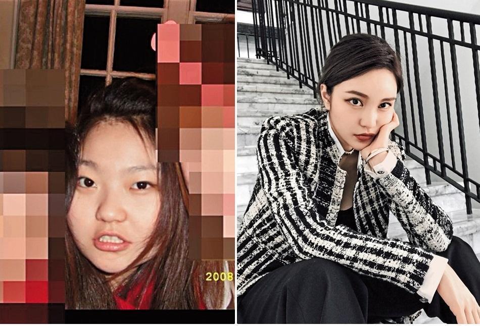 雖然周揚青本人整形前有些驚悚，但小豬力挺，還說在她沒整前就已認識。（翻攝自graccechowchowchowchow IG）