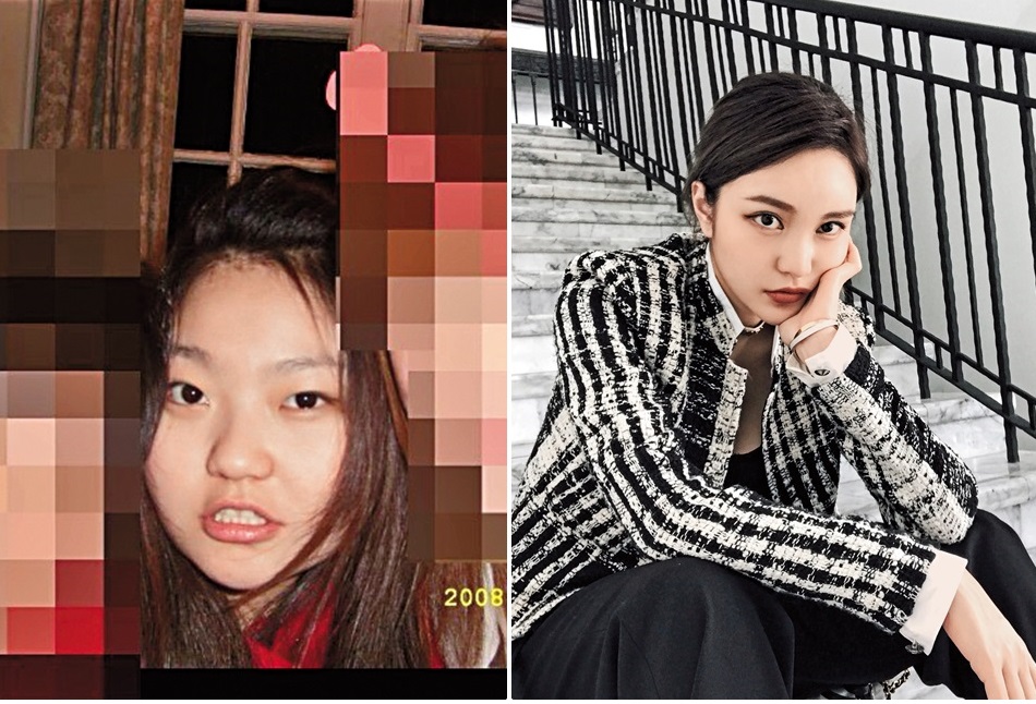 雖然周揚青本人整形前有些驚悚，但小豬力挺，還說在她沒整前就已認識。（翻攝自graccechowchowchowchow IG）