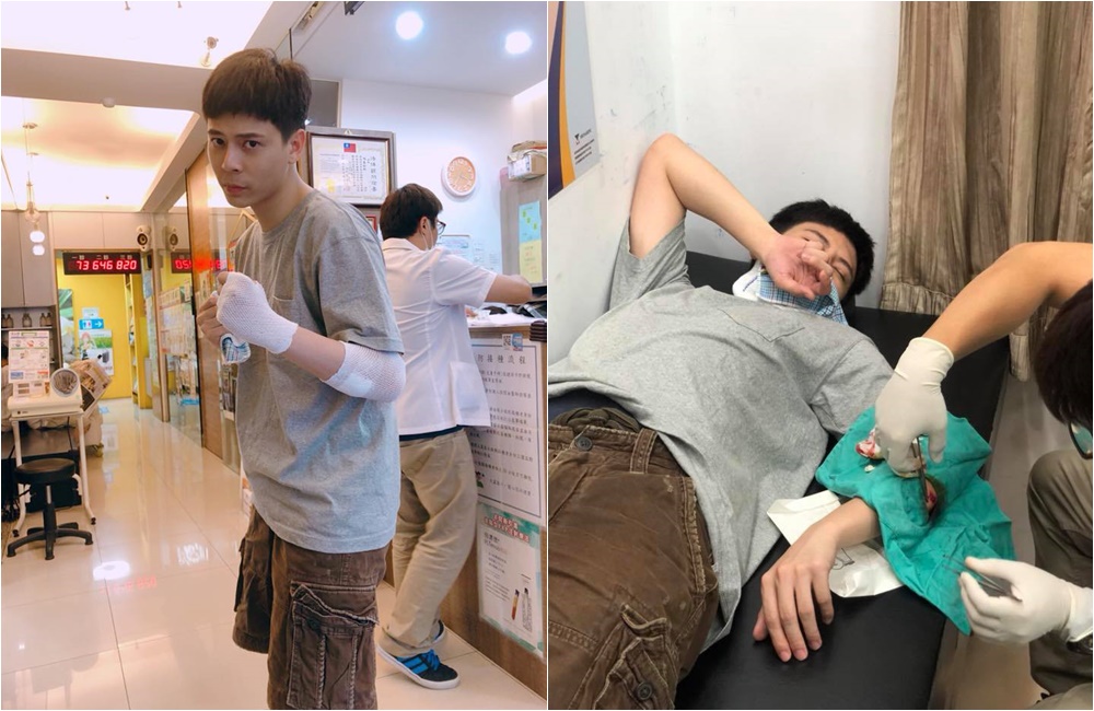柯朋宇被醫生包紮傷口，面露難過表情，包紮完之後，玩性大發比出拳擊手勢。（杉朋娛樂提供）