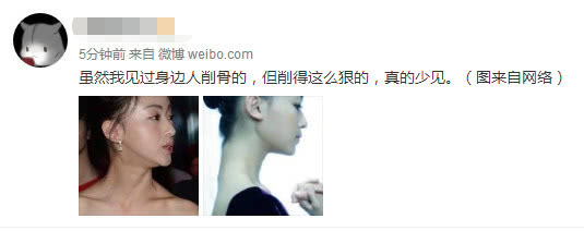 網曝吳謹言削骨，下手狠到粉絲認不出，遭調侃其臉上掛不住肉。