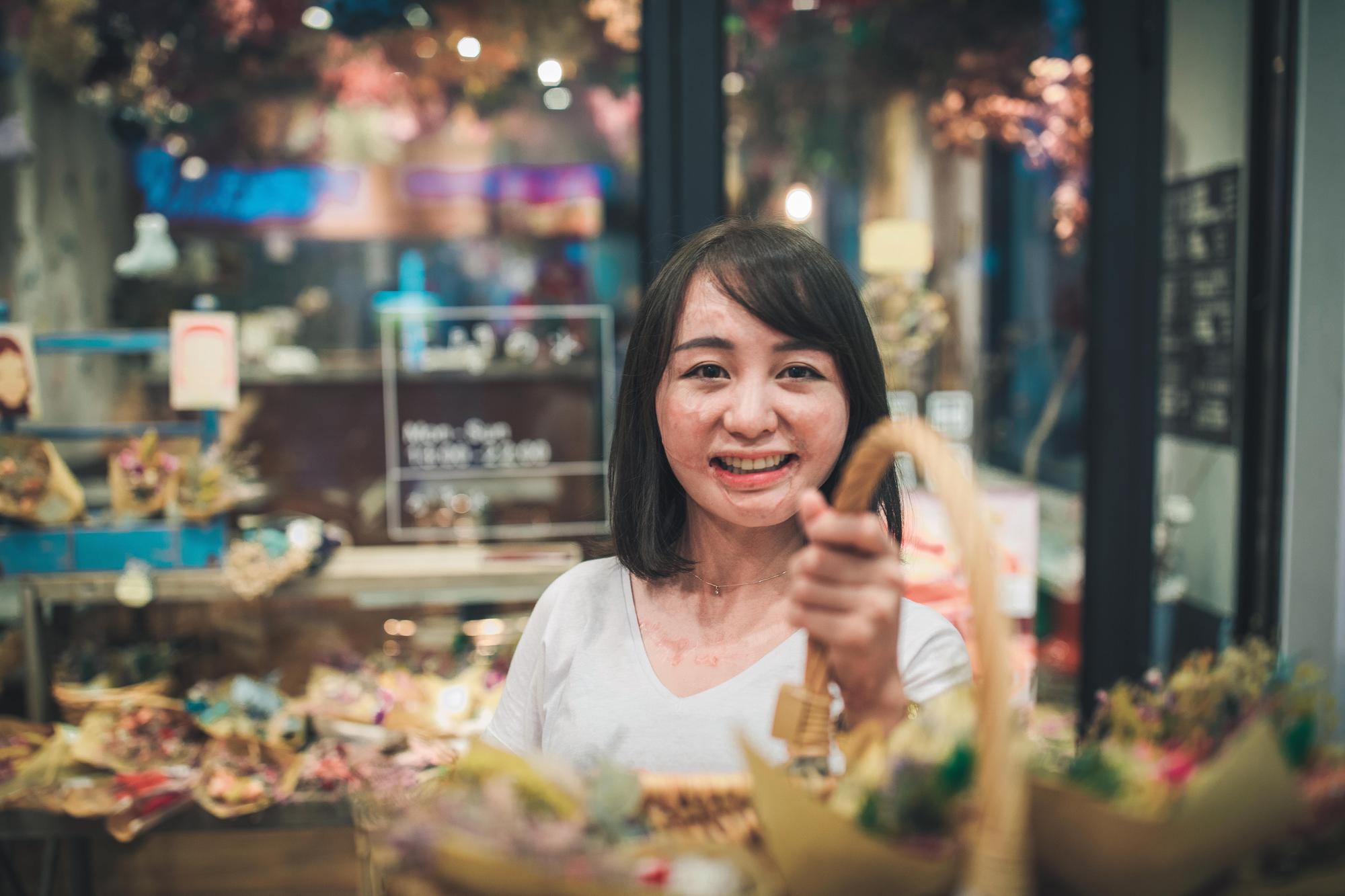 陳楚睿的攝影作品，皆以燒燙傷患者為對象。（陳楚睿提供）