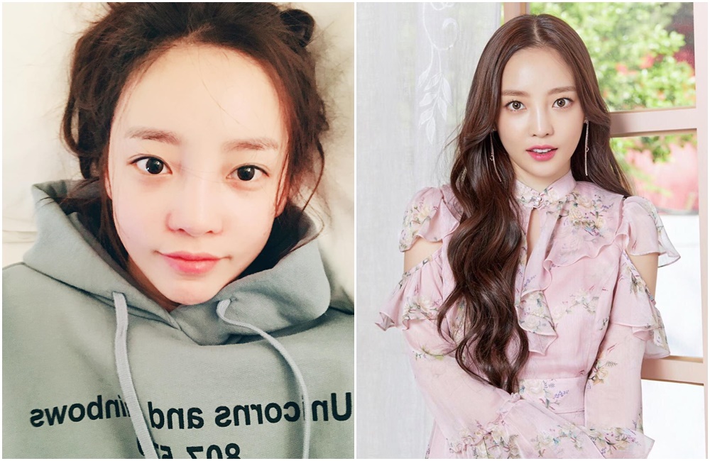 具荷拉全身瘀青照片被韓媒刊出。（取自具荷拉IG）