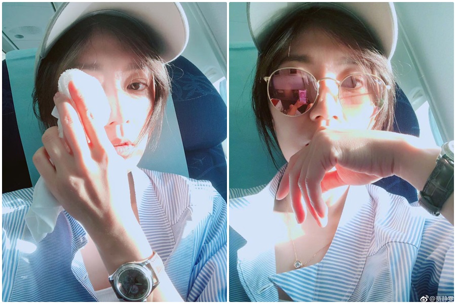 賈靜雯遮住被感染的眼睛，透露感染了角膜炎。（翻攝自賈靜雯臉書）