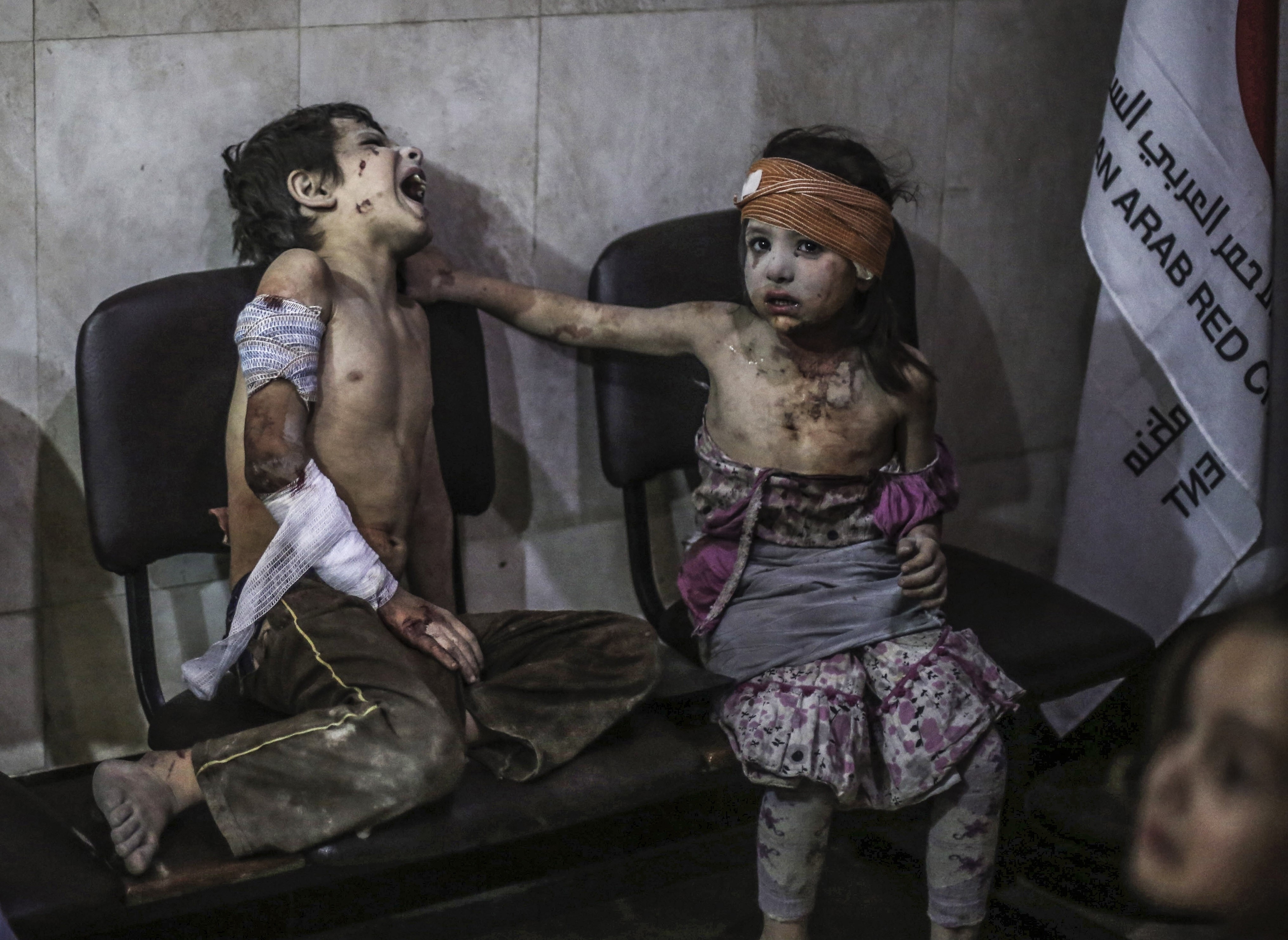 2015年8月22日，敘利亞杜馬郊區，在阿薩德政權的空襲後，受傷的孩子被送往敵對陣營的戰地醫院。（東方IC）