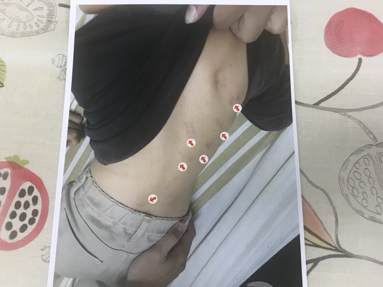 吳童被打得遍體鱗傷。（翻攝畫面）