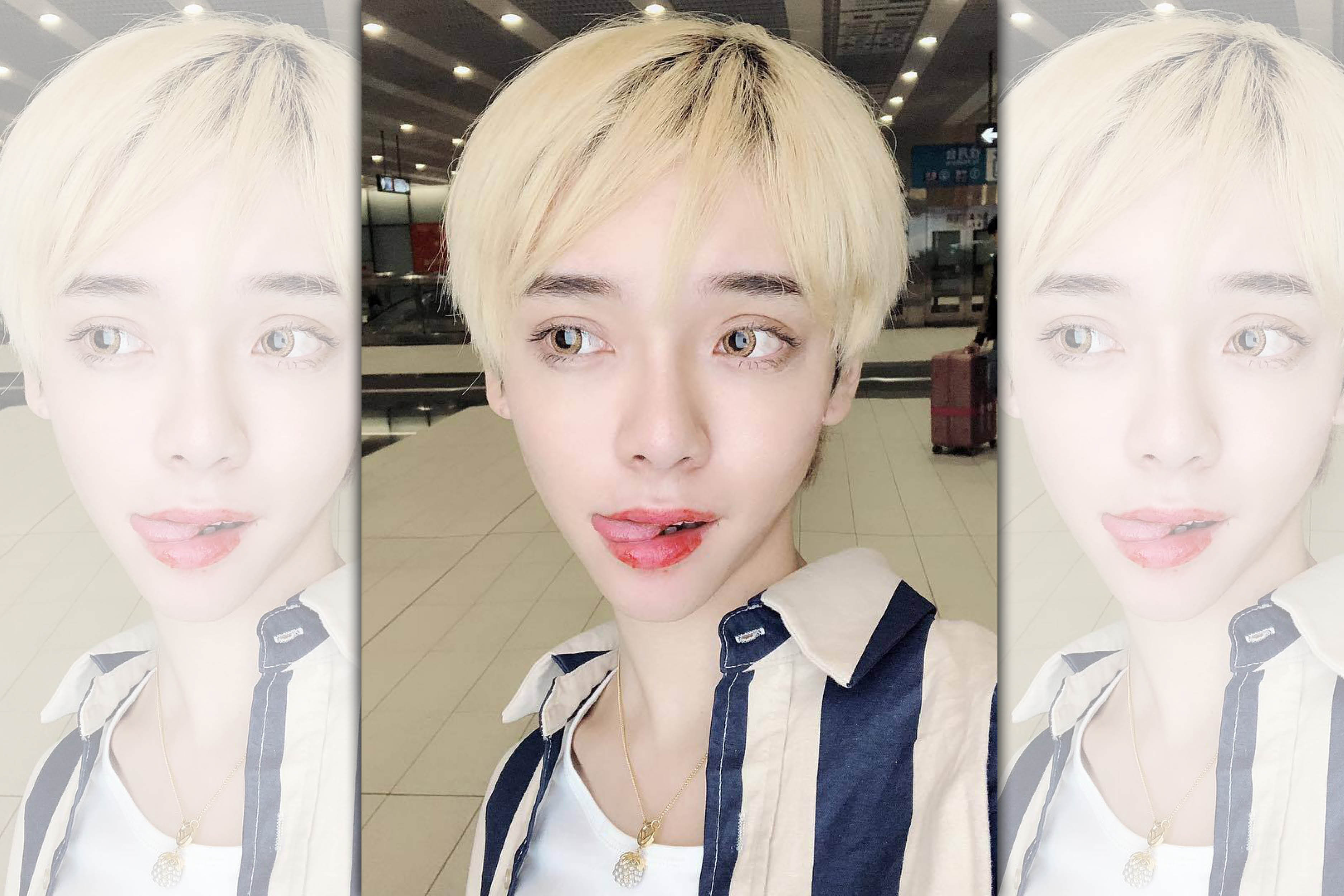 Kiwebaby 因為網友的酸言酸語決定削骨，她把偏男性面向、有稜角的顎骨削圓，讓線條看起來比較柔和，花了20萬元。（翻攝自Kiwebaby臉書）