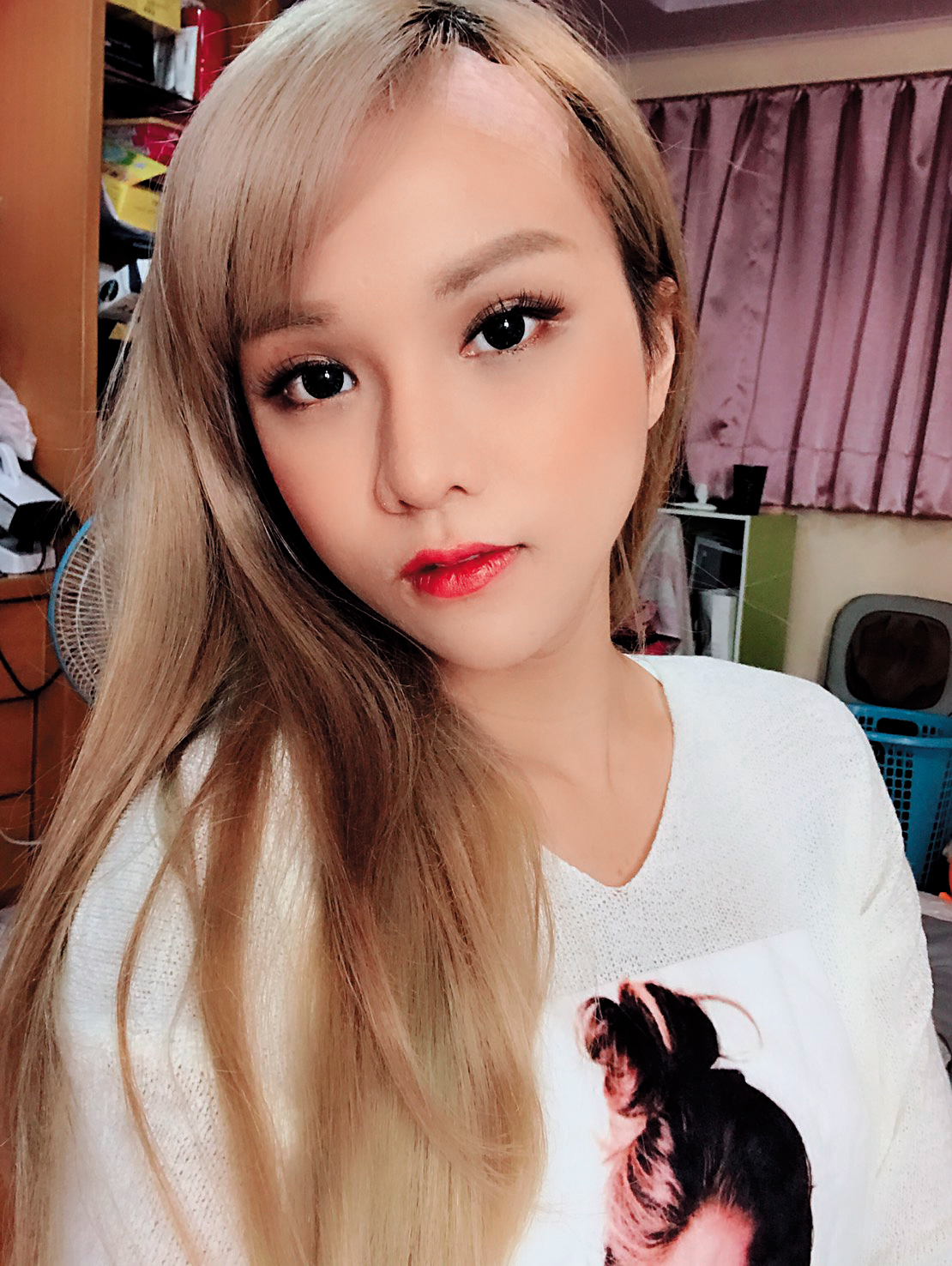 術後3個月，小A辣豔麗容貌更上一層，但額頭的疤痕還在修復。（小A辣提供）