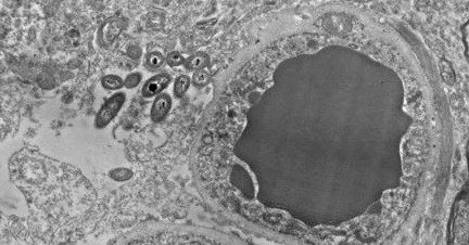 人腦切片的圖像顯示出細菌（血管左側），令人深思，但的確是「腦微生物」的「半揭面」。（來源：Science）